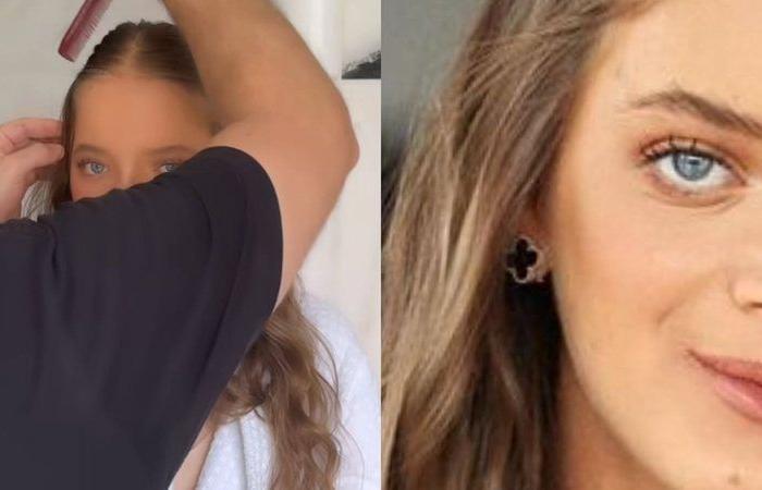 Rafaella Justus draws attention when she appears produced after rhinoplasty: ‘Perfect’