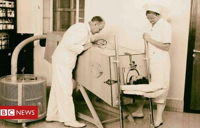 Iron lung: how the equipment paved the way for the modern ICU