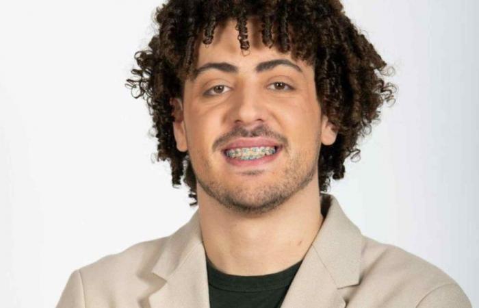 Alex Ferreira from “Big Brother 2024” had a facial tumor
