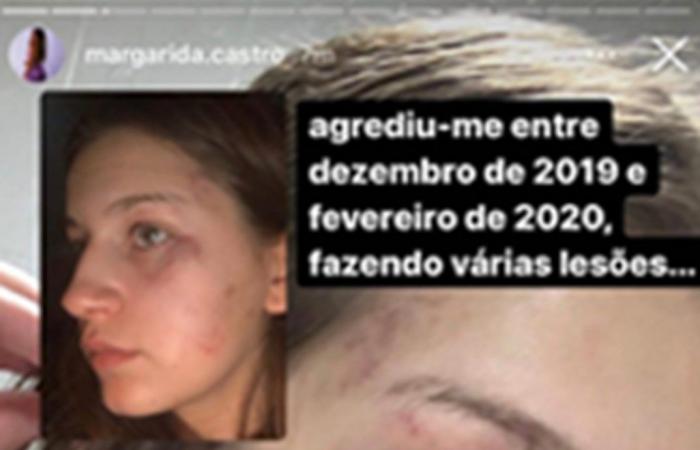 Margarida Castro, ‘Big Brother’ contestant, was beaten and threatened with death by her ex-boyfriend – Ferver