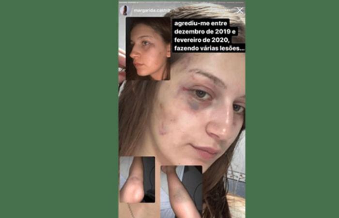 Margarida Castro, ‘Big Brother’ contestant, was beaten and threatened with death by her ex-boyfriend – Ferver