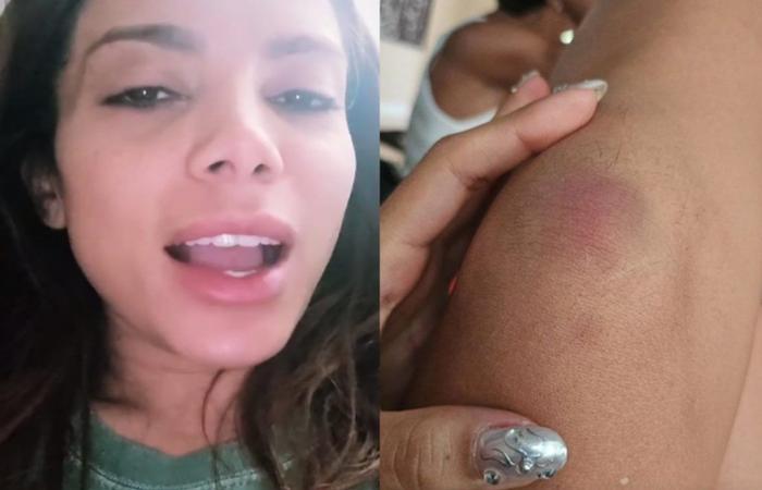 Anitta shows purple knees and says she fell on the floor with Juliette during her birthday party | Celebrities