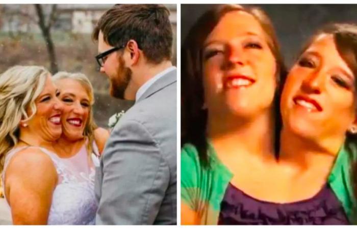 Siamese sisters whose lives were portrayed on a reality show reveal their marriage | Series