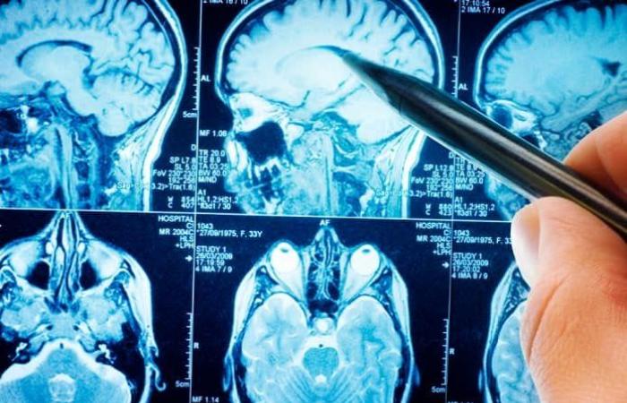 Neurological diseases are becoming more common; understand