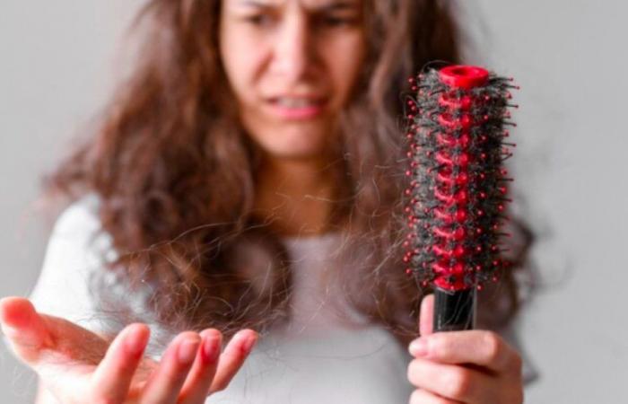 The relationship between dengue fever and hair loss: understand the case