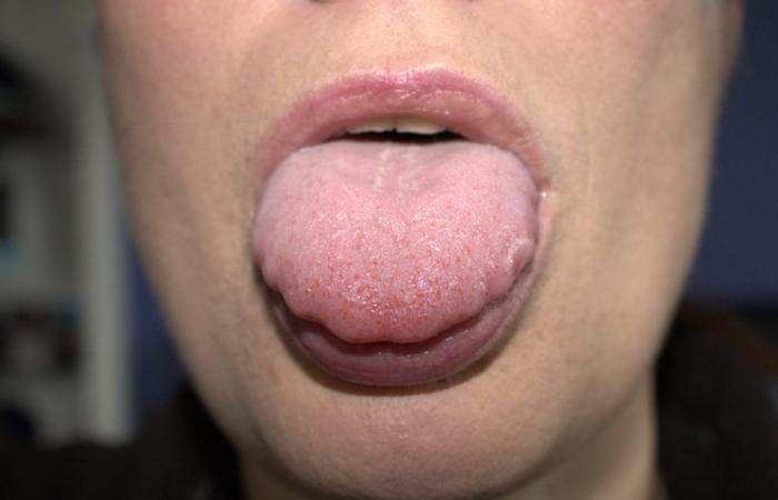 Is your tongue ‘cut out’? Find out what it can say about your health