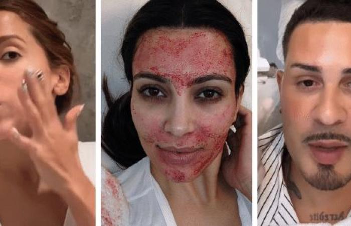 Celebrities use salmon semen, bee stings and even blood on their skin