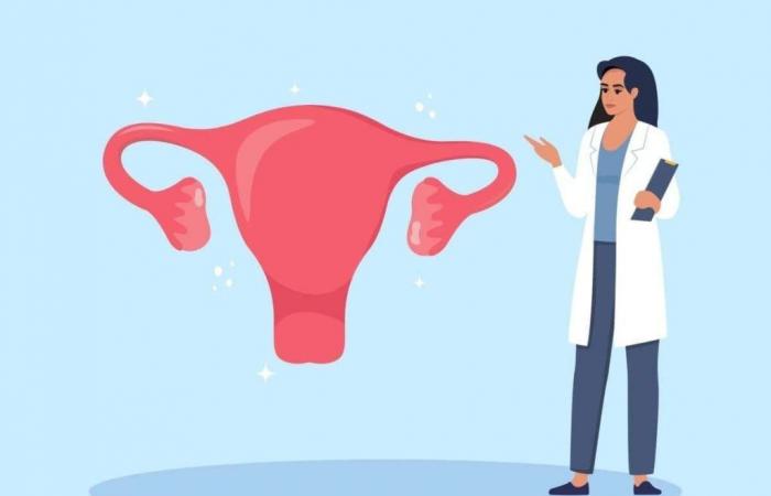 7 questions and answers about adenomyosis