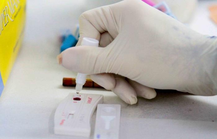Federal University of ES will test new medicine that promises to cure hepatitis B | Holy Spirit