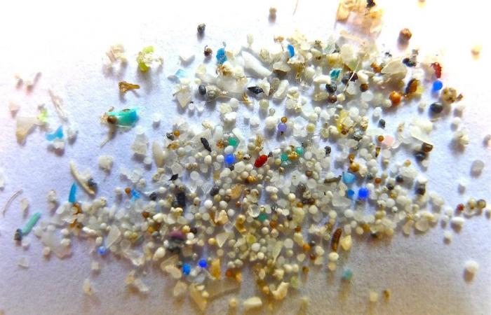 You even have microplastics in your brain, study warns