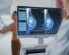 Breast cancer: mortality rate increases by almost 90% in Brazil; understand the reasons