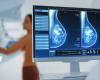 Mammography and AI can anticipate breast cancer diagnosis in young patients