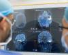 Gray May: brain cancer awareness month, alerts population; understand the symptoms