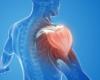 Understand how the shoulder can signal diabetes
