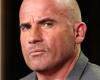 Fractured skull and crushed nose: Dominic Purcell suffered serious accident
