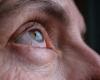 How eyes can indicate Alzheimer’s risk 12 years earlier