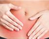 Endometriosis: Know the condition and its implications